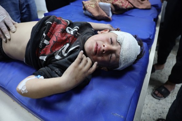Slovenia receives 7 injured Palestinian children for medical treatment Slovenia receives 7 injured Palestinian children for medical treatment