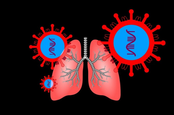 Artificial organ keeps patient alive for 48 hours after removal of bilateral lungs Artificial organ keeps patient alive for 48 hours after removal of bilateral lungs